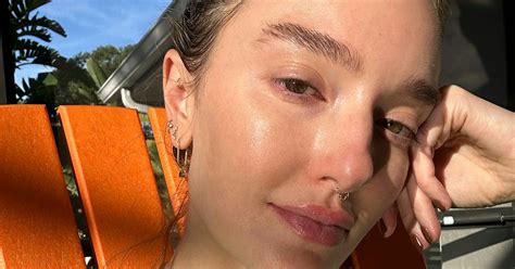 tca peel reviews|I Tried A Trichloroacetic Acid Peel For My Stubborn Melasma.